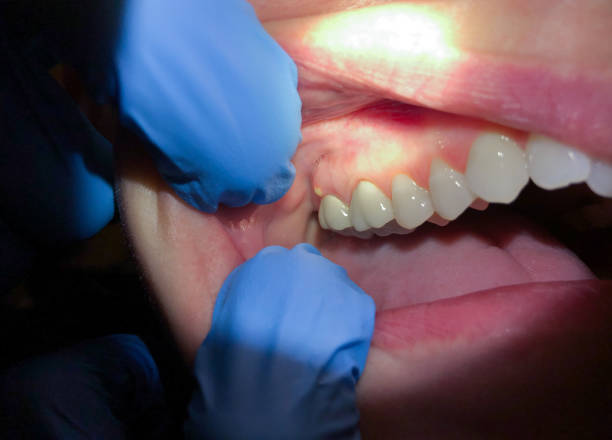 Best Teeth Whitening  in Munising, MI