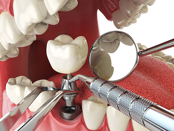 Best Tooth Infection Emergency Dentist  in Munising, MI
